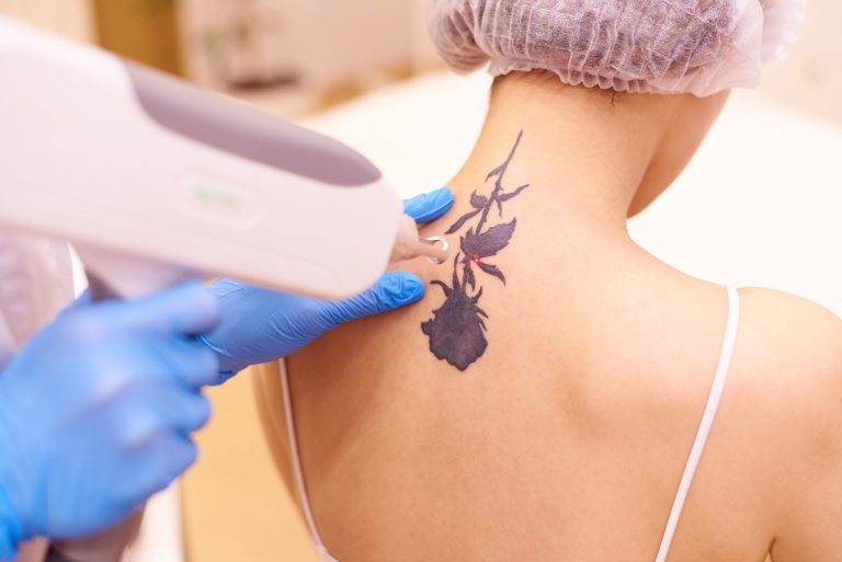 tattoo cover-up